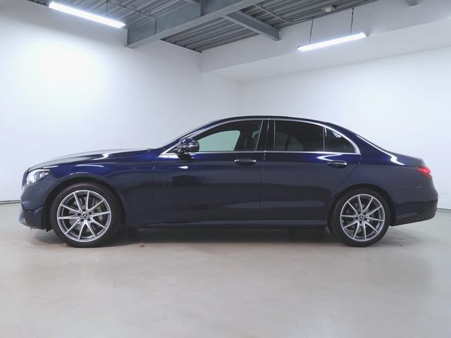 E300 スポーツ フロントメモリーパッケージ エクスクルーシブパッケージ